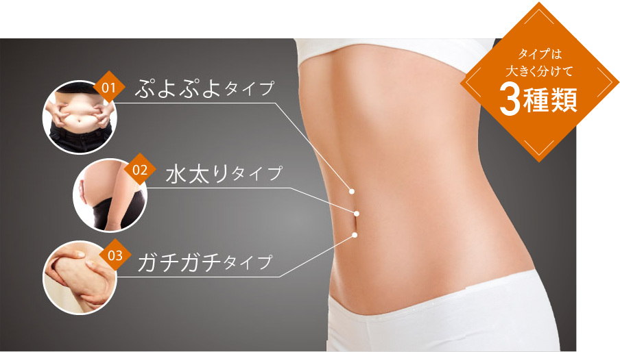 01 ぷよぷよタイプ 皮下脂肪が蓄積したタイプ。肉質が柔らかいのが特徴。02 水太りタイプ いわゆるむくみ太り。血行不良や筋肉量の低下が原因。03 ガチガチタイプ 脂肪と老廃物がくっつき、固太りしたタイプ。 肉質タイプは大きく分けて3種類