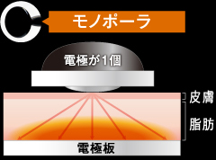 モノポーラ 電極が1個 皮膚 脂肪 電極板