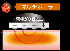 マルチポーラ 電極が3個以上